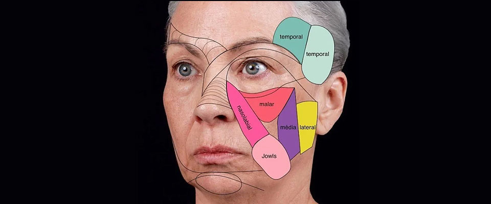 A imagem mostra uma mulher idosa, com cabelos grisalhos presos em um coque para trás. Na face, ela tem diversas linhas pretas desenhadas, e também formas colo0ridas que sinalizam os coxins de gordura facial. O fundo da imagem é preto. 