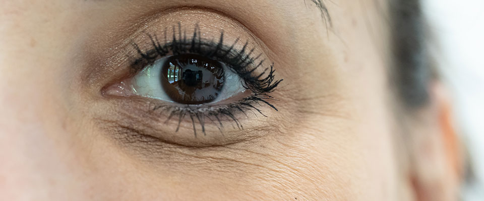 A imagem mostra o olho de uma mulher. Seu olho é castanho, e sua pálpebra inferior possui marcas de expressão.