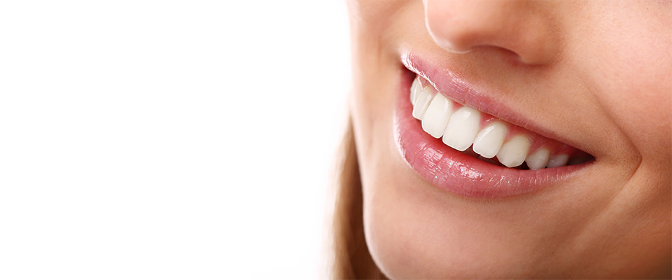 A imagem mostra a parte inferior do rosto de uma mulher com pele branca. Ela está sorrindo, com os dentes à mostra. O fundo da imagem é branco.